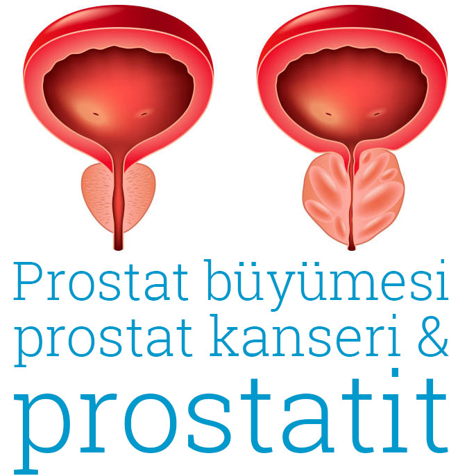 Dr. Hakan Özkul Kısırlık Tedavisi